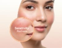 Sensitivity & Redness